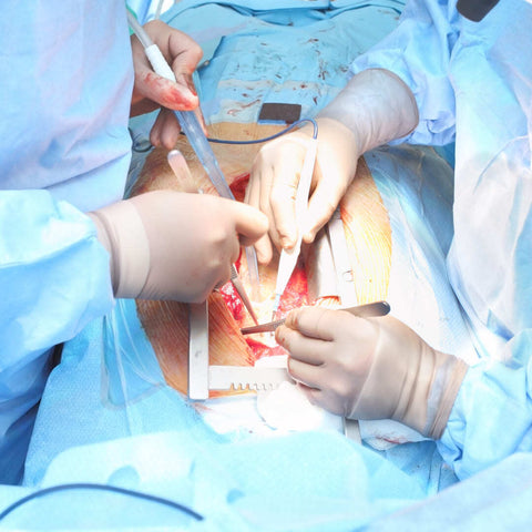 Surgeons perform an open heart surgery