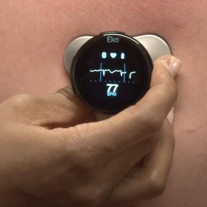 Tiger TV: AI in Digital Stethoscopes Detecting Early Symptoms of Heart Disease for LSU Athletes