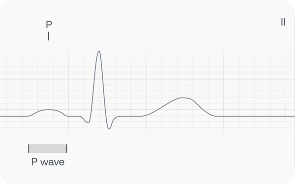 Graphical representation of an ECG highlighting the P-wave